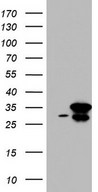 HEK293T cells were transfected with the pCMV6-ENTRY control (Left lane) or pCMV6-ENTRY C14orf166 (Right lane) cDNA for 48 hrs and lysed. Equivalent amounts of cell lysates (5 ug per lane) were separated by SDS-PAGE and immunoblotted with anti-C14orf166.