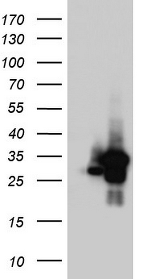 HEK293T cells were transfected with the pCMV6-ENTRY control (Left lane) or pCMV6-ENTRY C14orf166 (Right lane) cDNA for 48 hrs and lysed. Equivalent amounts of cell lysates (5 ug per lane) were separated by SDS-PAGE and immunoblotted with anti-C14orf166.