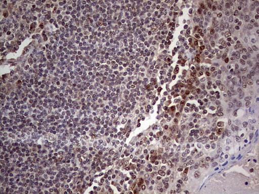 IHC of paraffin-embedded Human tonsil using anti-C14orf166 mouse monoclonal antibody. (Heat-induced epitope retrieval by 1 mM EDTA in 10mM Tris, pH8.5, 120°C for 3min).