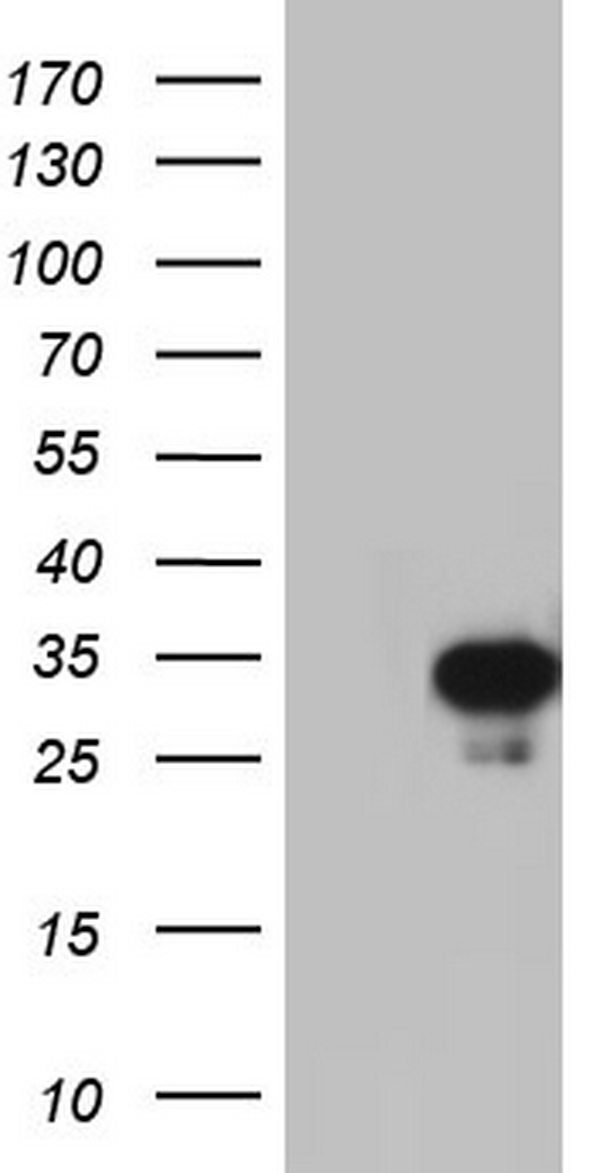 HEK293T cells were transfected with the pCMV6-ENTRY control (Left lane) or pCMV6-ENTRY C14orf166 (Right lane) cDNA for 48 hrs and lysed. Equivalent amounts of cell lysates (5 ug per lane) were separated by SDS-PAGE and immunoblotted with anti-C14orf166.