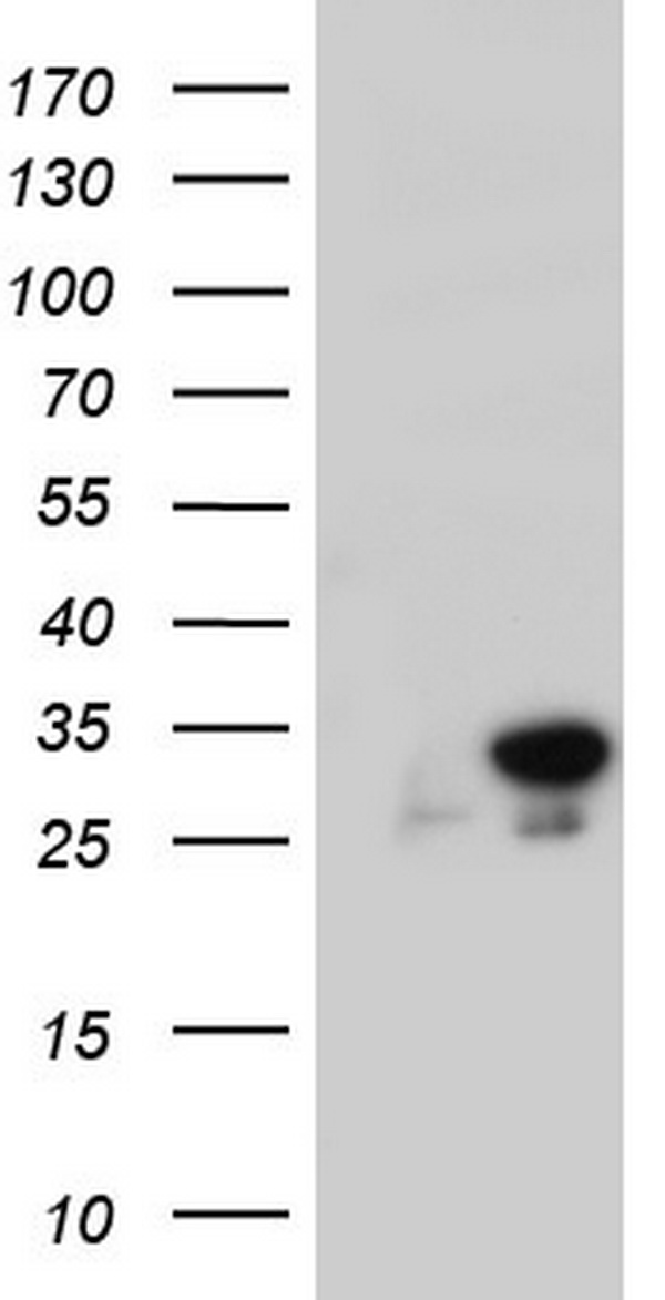 HEK293T cells were transfected with the pCMV6-ENTRY control (Left lane) or pCMV6-ENTRY C14orf166 (Right lane) cDNA for 48 hrs and lysed. Equivalent amounts of cell lysates (5 ug per lane) were separated by SDS-PAGE and immunoblotted with anti-C14orf166.