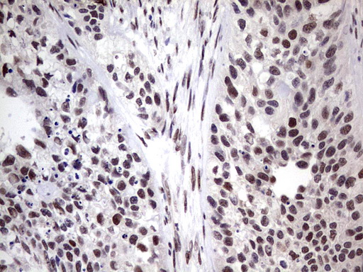 IHC of paraffin-embedded Carcinoma of Human kidney tissue using anti-C14orf166 mouse monoclonal antibody. (Heat-induced epitope retrieval by 1 mM EDTA in 10mM Tris, pH8.5, 120°C for 3min).