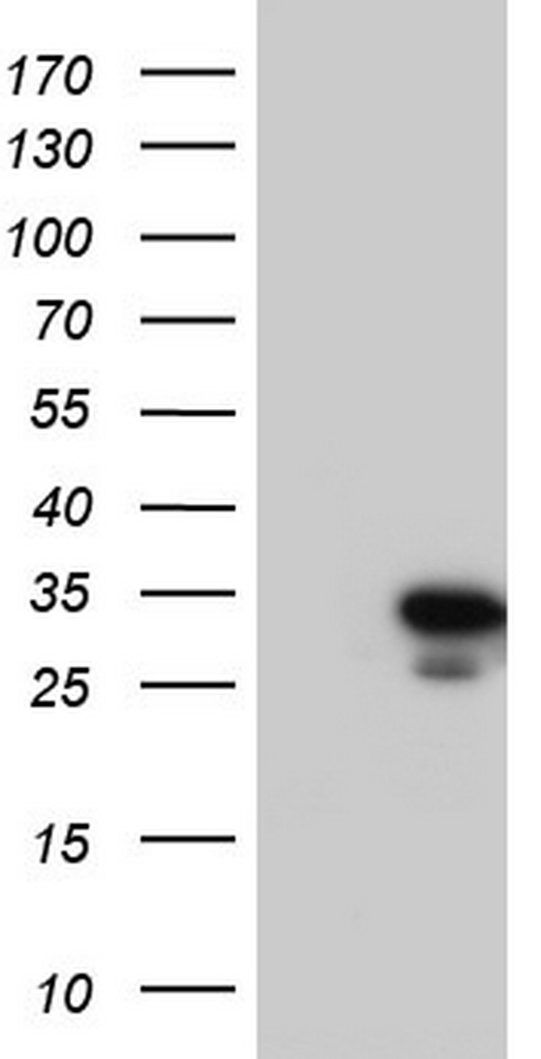 HEK293T cells were transfected with the pCMV6-ENTRY control (Left lane) or pCMV6-ENTRY C14orf166 (Right lane) cDNA for 48 hrs and lysed. Equivalent amounts of cell lysates (5 ug per lane) were separated by SDS-PAGE and immunoblotted with anti-C14orf166.