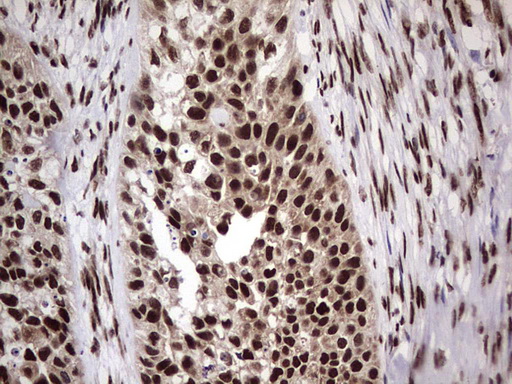 IHC of paraffin-embedded Carcinoma of Human kidney tissue using anti-C14orf166 mouse monoclonal antibody. (Heat-induced epitope retrieval by 1 mM EDTA in 10mM Tris, pH8.5, 120°C for 3min).