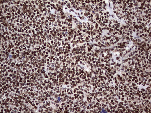 IHC of paraffin-embedded Human lymphoma tissue using anti-C14orf166 mouse monoclonal antibody. (Heat-induced epitope retrieval by 1 mM EDTA in 10mM Tris, pH8.5, 120°C for 3min).