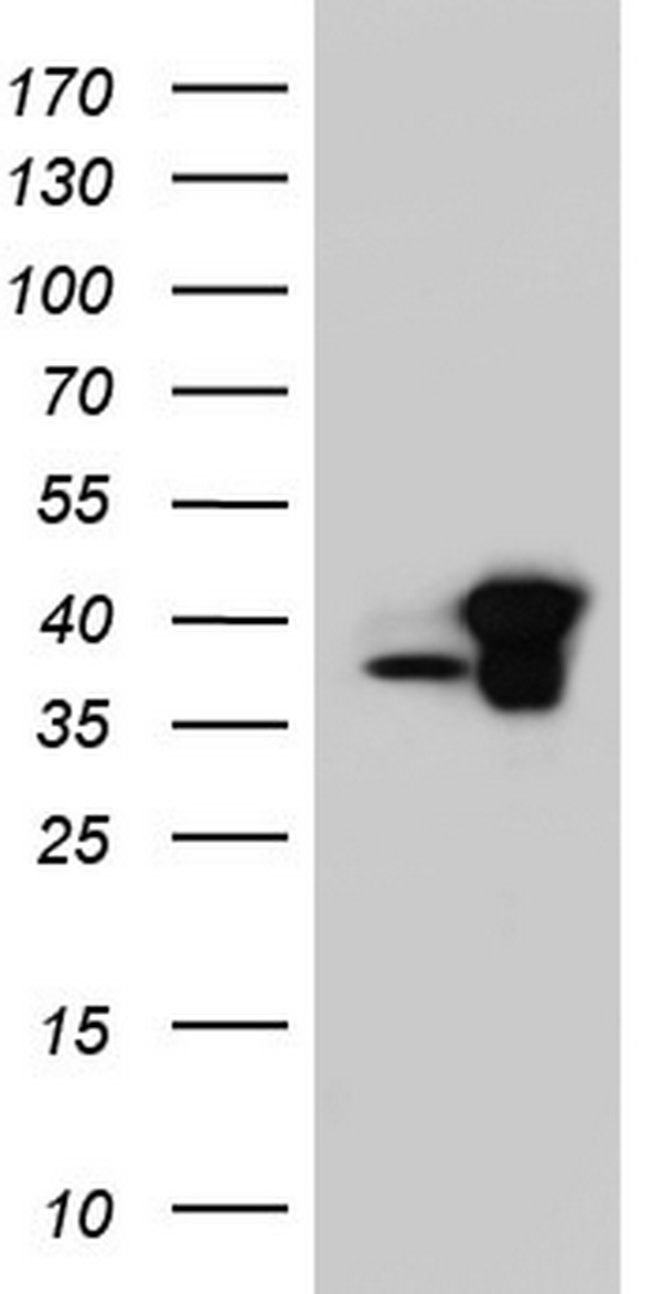 HEK293T cells were transfected with the pCMV6-ENTRY control (Left lane) or pCMV6-ENTRY C14orf166 (Right lane) cDNA for 48 hrs and lysed. Equivalent amounts of cell lysates (5 ug per lane) were separated by SDS-PAGE and immunoblotted with anti-C14orf166.
