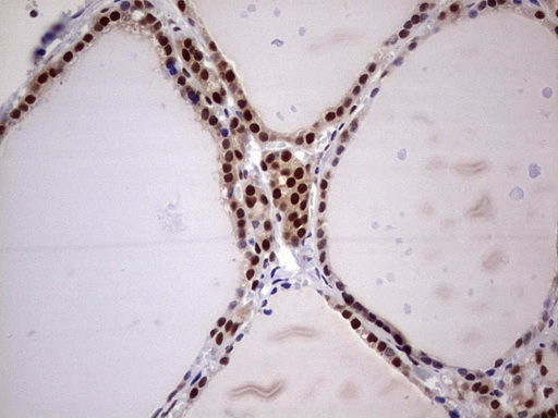 IHC of paraffin-embedded Human thyroid tissue using anti-C14orf166 mouse monoclonal antibody. (Heat-induced epitope retrieval by 1 mM EDTA in 10mM Tris, pH8.5, 120°C for 3min).