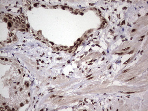 IHC of paraffin-embedded Human prostate tissue using anti-C14orf166 mouse monoclonal antibody. (Heat-induced epitope retrieval by 1 mM EDTA in 10mM Tris, pH8.5, 120°C for 3min).