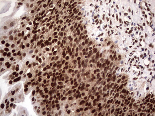 IHC of paraffin-embedded Human bladder tissue using anti-C14orf166 mouse monoclonal antibody. (Heat-induced epitope retrieval by 1 mM EDTA in 10mM Tris, pH8.5, 120°C for 3min).