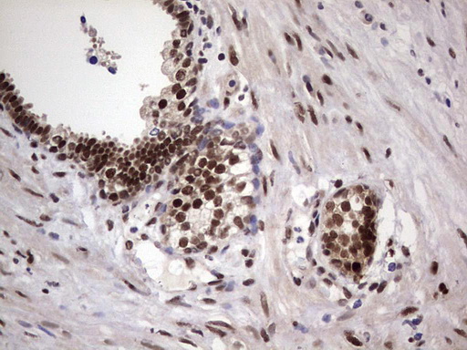 IHC of paraffin-embedded Carcinoma of Human prostate tissue using anti-C14orf166 mouse monoclonal antibody. (Heat-induced epitope retrieval by 1 mM EDTA in 10mM Tris, pH8.5, 120°C for 3min).