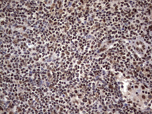 IHC of paraffin-embedded Human lymph node tissue using anti-C14orf166 mouse monoclonal antibody. (Heat-induced epitope retrieval by 1 mM EDTA in 10mM Tris, pH8.5, 120°C for 3min).