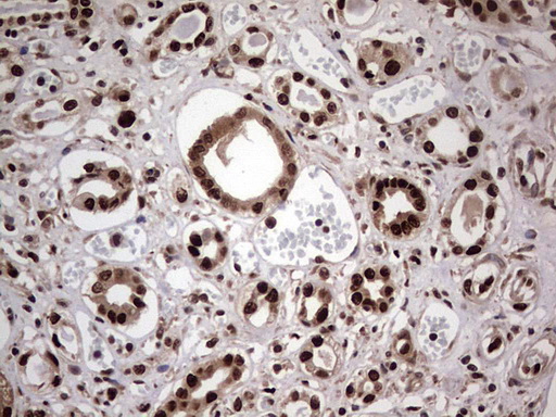 IHC of paraffin-embedded Human Kidney tissue using anti-C14orf166 mouse monoclonal antibody. (Heat-induced epitope retrieval by 1 mM EDTA in 10mM Tris, pH8.5, 120°C for 3min).