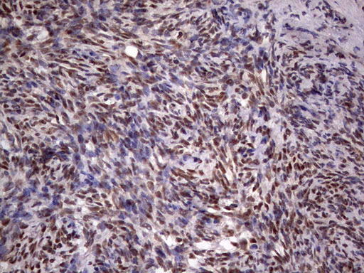 IHC of paraffin-embedded Human Ovary tissue using anti-C14orf166 mouse monoclonal antibody. (Heat-induced epitope retrieval by 1 mM EDTA in 10mM Tris, pH8.5, 120°C for 3min).