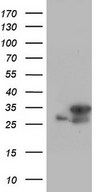HEK293T cells were transfected with the pCMV6-ENTRY control (Left lane) or pCMV6-ENTRY C14orf166 (Right lane) cDNA for 48 hrs and lysed. Equivalent amounts of cell lysates (5 ug per lane) were separated by SDS-PAGE and immunoblotted with anti-C14orf166.