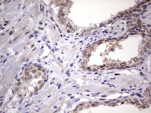 IHC of paraffin-embedded Human prostate tissue using anti-C14orf166 mouse monoclonal antibody. (Heat-induced epitope retrieval by 1 mM EDTA in 10mM Tris, pH8.5, 120°C for 3min).