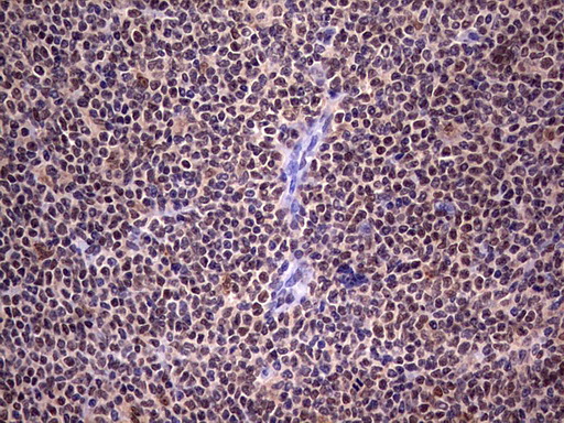 IHC of paraffin-embedded Human lymphoma tissue using anti-C14orf166 mouse monoclonal antibody. (Heat-induced epitope retrieval by 1 mM EDTA in 10mM Tris, pH8.5, 120°C for 3min).