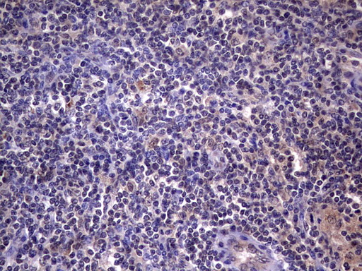 IHC of paraffin-embedded Human lymph node tissue using anti-C14orf166 mouse monoclonal antibody. (Heat-induced epitope retrieval by 1 mM EDTA in 10mM Tris, pH8.5, 120°C for 3min).