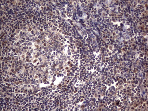 IHC of paraffin-embedded Human tonsil using anti-C14orf166 mouse monoclonal antibody. (Heat-induced epitope retrieval by 1 mM EDTA in 10mM Tris, pH8.5, 120°C for 3min).