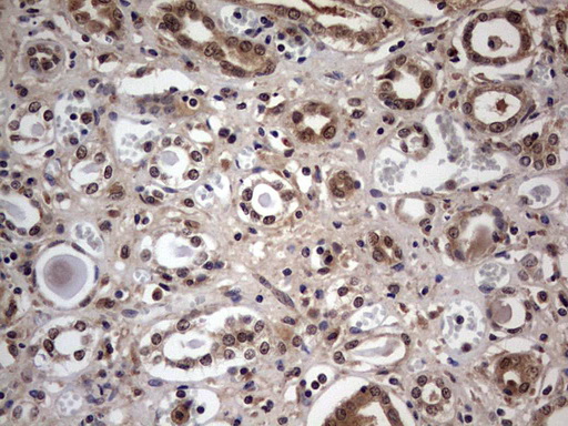 IHC of paraffin-embedded Human Kidney tissue using anti-C14orf166 mouse monoclonal antibody. (Heat-induced epitope retrieval by 1 mM EDTA in 10mM Tris, pH8.5, 120°C for 3min).
