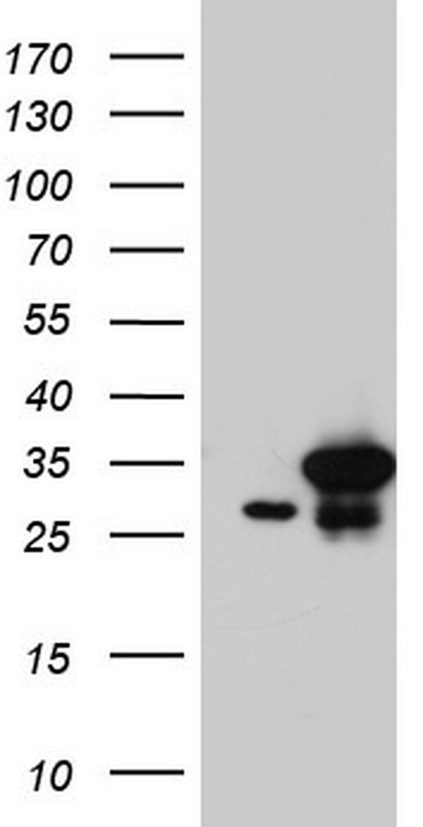 HEK293T cells were transfected with the pCMV6-ENTRY control (Left lane) or pCMV6-ENTRY C14orf166 (Right lane) cDNA for 48 hrs and lysed. Equivalent amounts of cell lysates (5 ug per lane) were separated by SDS-PAGE and immunoblotted with anti-C14orf166.
