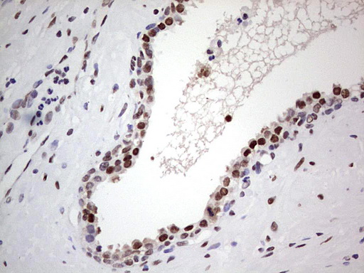 IHC of paraffin-embedded Human prostate tissue using anti-C14orf166 mouse monoclonal antibody. (Heat-induced epitope retrieval by 1 mM EDTA in 10mM Tris, pH8.5, 120°C for 3min).