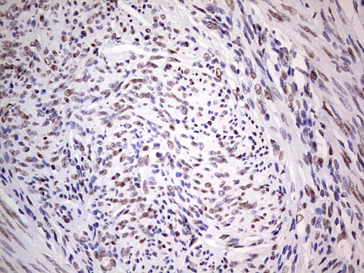 IHC of paraffin-embedded Human endometrium tissue using anti-C14orf166 mouse monoclonal antibody. (Heat-induced epitope retrieval by 1 mM EDTA in 10mM Tris, pH8.5, 120°C for 3min).