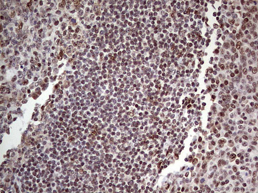 IHC of paraffin-embedded Human tonsil using anti-C14orf166 mouse monoclonal antibody. (Heat-induced epitope retrieval by 1 mM EDTA in 10mM Tris, pH8.5, 120°C for 3min).