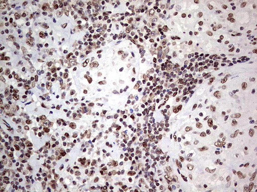 IHC of paraffin-embedded Human lymph node tissue using anti-C14orf166 mouse monoclonal antibody. (Heat-induced epitope retrieval by 1 mM EDTA in 10mM Tris, pH8.5, 120°C for 3min).