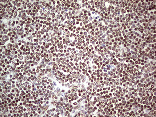 IHC of paraffin-embedded Human lymphoma tissue using anti-C14orf166 mouse monoclonal antibody. (Heat-induced epitope retrieval by 1 mM EDTA in 10mM Tris, pH8.5, 120°C for 3min).