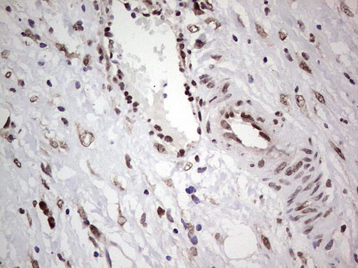 IHC of paraffin-embedded Carcinoma of Human bladder tissue using anti-C14orf166 mouse monoclonal antibody. (Heat-induced epitope retrieval by 1 mM EDTA in 10mM Tris, pH8.5, 120°C for 3min).