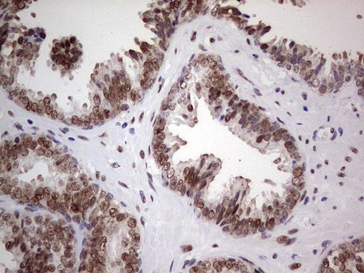 IHC of paraffin-embedded Carcinoma of Human prostate tissue using anti-C14orf166 mouse monoclonal antibody. (Heat-induced epitope retrieval by 1 mM EDTA in 10mM Tris, pH8.5, 120°C for 3min).