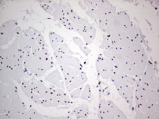 IHC of paraffin-embedded Human bladder tissue using anti-C14orf166 mouse monoclonal antibody. (Heat-induced epitope retrieval by 1 mM EDTA in 10mM Tris, pH8.5, 120°C for 3min).
