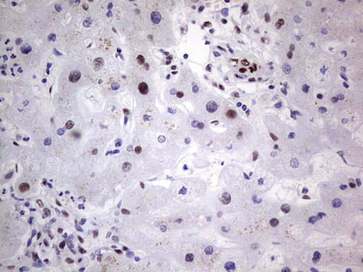 IHC of paraffin-embedded Human liver tissue using anti-C14orf166 mouse monoclonal antibody. (Heat-induced epitope retrieval by 1 mM EDTA in 10mM Tris, pH8.5, 120°C for 3min).