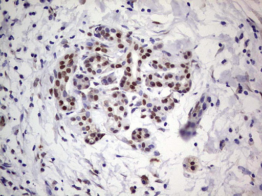 IHC of paraffin-embedded Carcinoma of Human pancreas tissue using anti-C14orf166 mouse monoclonal antibody. (Heat-induced epitope retrieval by 1 mM EDTA in 10mM Tris, pH8.5, 120°C for 3min).