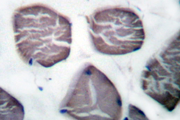IHC of Actin-3/2 (E2) pAb in paraffin-embedded human muscle tissue.
