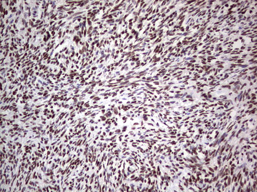 IHC of paraffin-embedded Human Ovary tissue using anti-C14orf166 mouse monoclonal antibody. (Heat-induced epitope retrieval by 1 mM EDTA in 10mM Tris, pH8.5, 120°C for 3min).