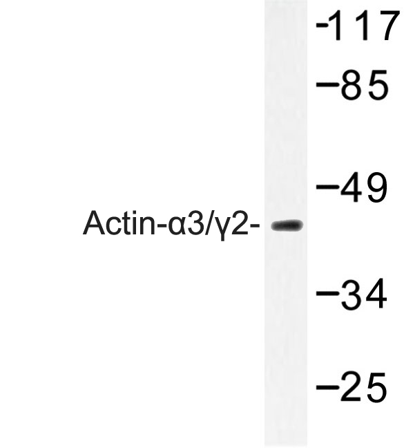Western blot of Actin-3/2 (E2) pAb in extracts from COLO205 cells.
