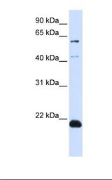 Transfected 293T cell lysate. Antibody concentration: 1.0 ug/ml. Gel concentration: 12%.