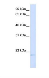 Transfected 293T cell lysate. Antibody concentration: 1.0 ug/ml. Gel concentration: 12%.