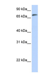 C14orf37 antibody LS-C102098 Western blot of Fetal Lung lysate.
