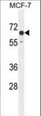 CO027 Antibody western blot of MCF-7 cell line lysates (35 ug/lane). The CO027 antibody detected the CO027 protein (arrow).