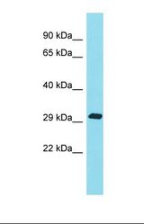 Western blot of Human COLO205. KATNBL1 antibody dilution 1.0 ug/ml.
