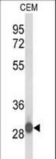 Western blot of C15orf29 Antibody in CEM cell line lysates (35 ug/lane). C15orf29 (arrow) was detected using the purified antibody.