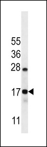 CO040 Antibody western blot of Ramos cell line lysates (35 ug/lane). The CO040 antibody detected the CO040 protein (arrow).