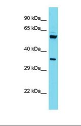 Western blot of Human HepG2. C15orf41 antibody dilution 1.0 ug/ml.