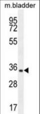 C15orf41 Antibody western blot of mouse bladder tissue lysates (35 ug/lane). The C15orf41 antibody detected the C15orf41 protein (arrow).