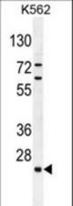 C15orf41 Antibody western blot of K562 cell line lysates (35 ug/lane). The C15orf41 antibody detected the C15orf41 protein (arrow).
