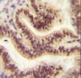 CP045 antibody immunohistochemistry of formalin-fixed and paraffin-embedded human uterus tissue followed by peroxidase-conjugated secondary antibody and DAB staining.