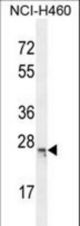 CP045 Antibody western blot of NCI-H460 cell line lysates (35 ug/lane). The CP045 antibody detected the CP045 protein (arrow).