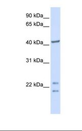 Fetal brain lysate. Antibody concentration: 1.0 ug/ml. Gel concentration: 12%.